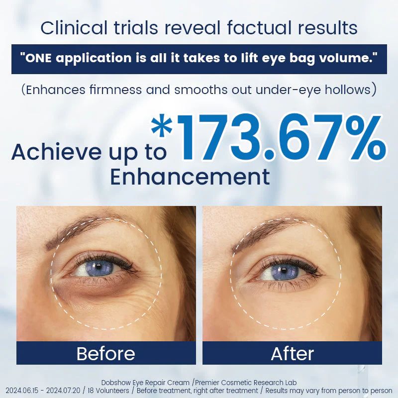 Eye Bag Removal Cream- 💖Buy 1 Get 1 Free (2 PCS)💖