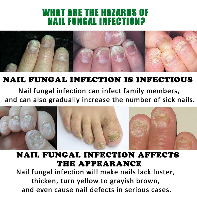 Ginger Nail Care Solution