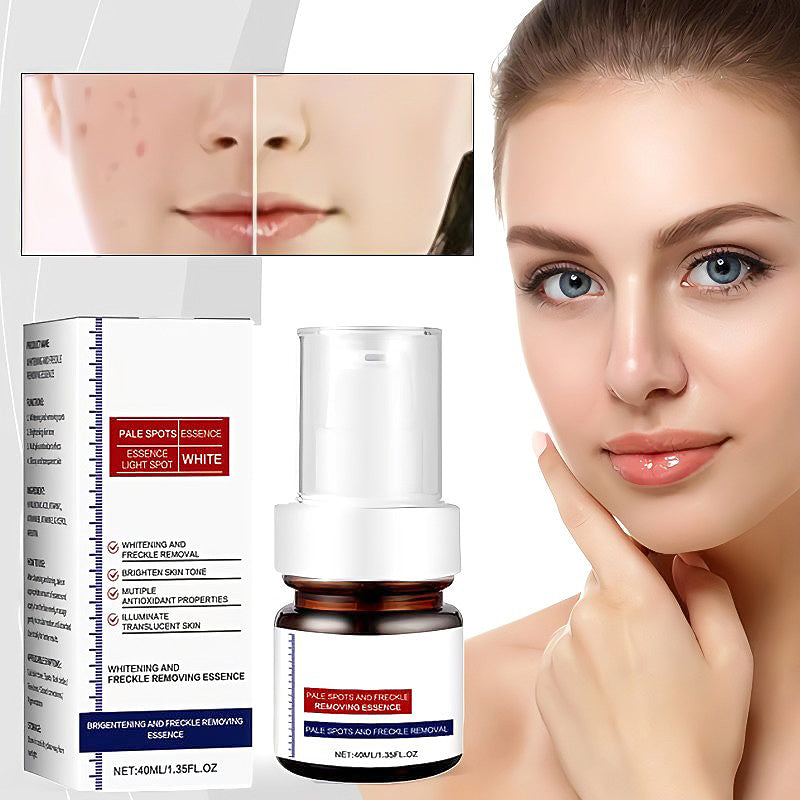 Vitamin C Freckle Whitening Cream - Buy 1 Get 1 Free (2 pcs)