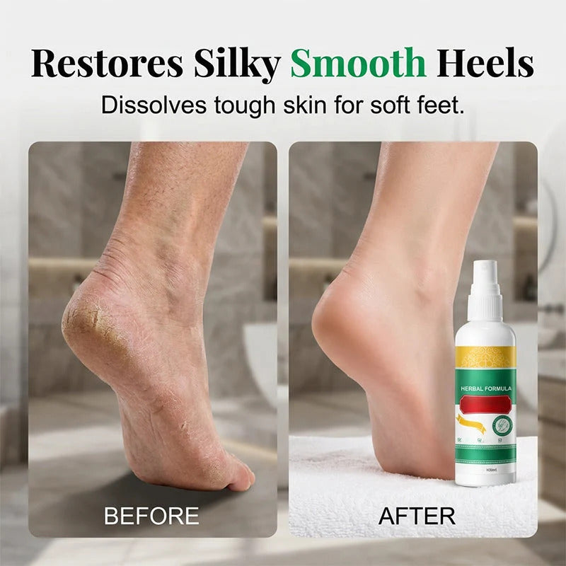 Plant-based refreshing foot spray