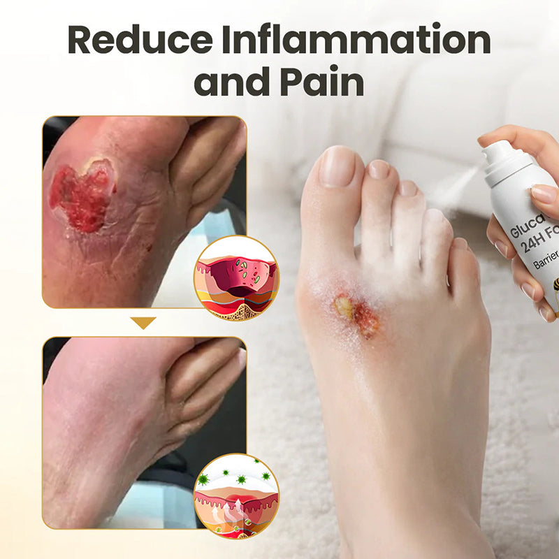 Foot Protection Spray