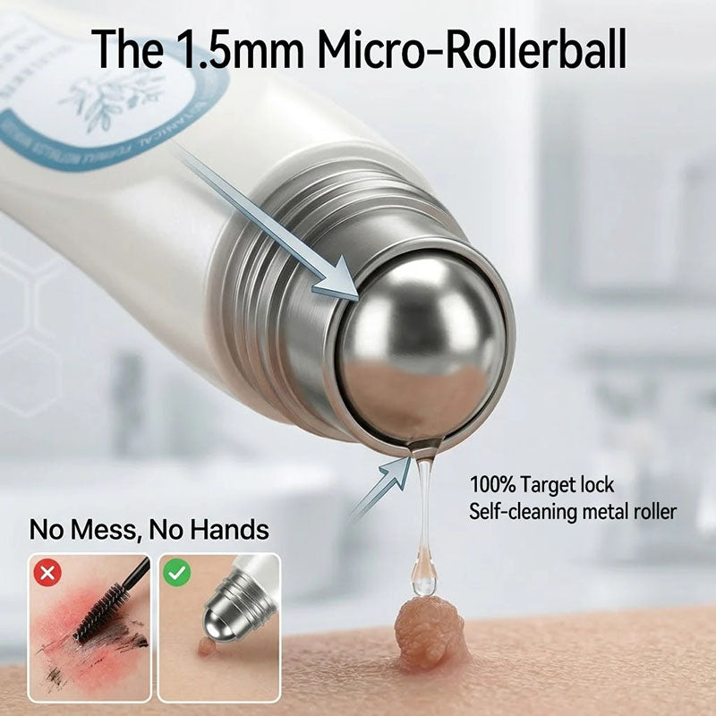 Advanced rollerball product for removing moles and warts