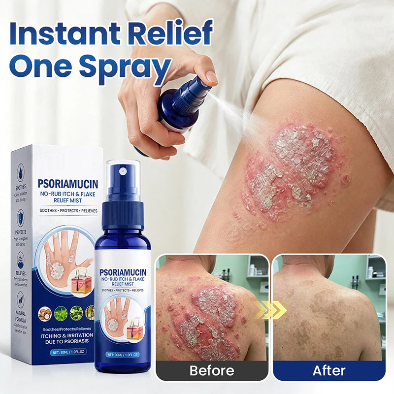 No-Rub Itch & Flake Relief Mist