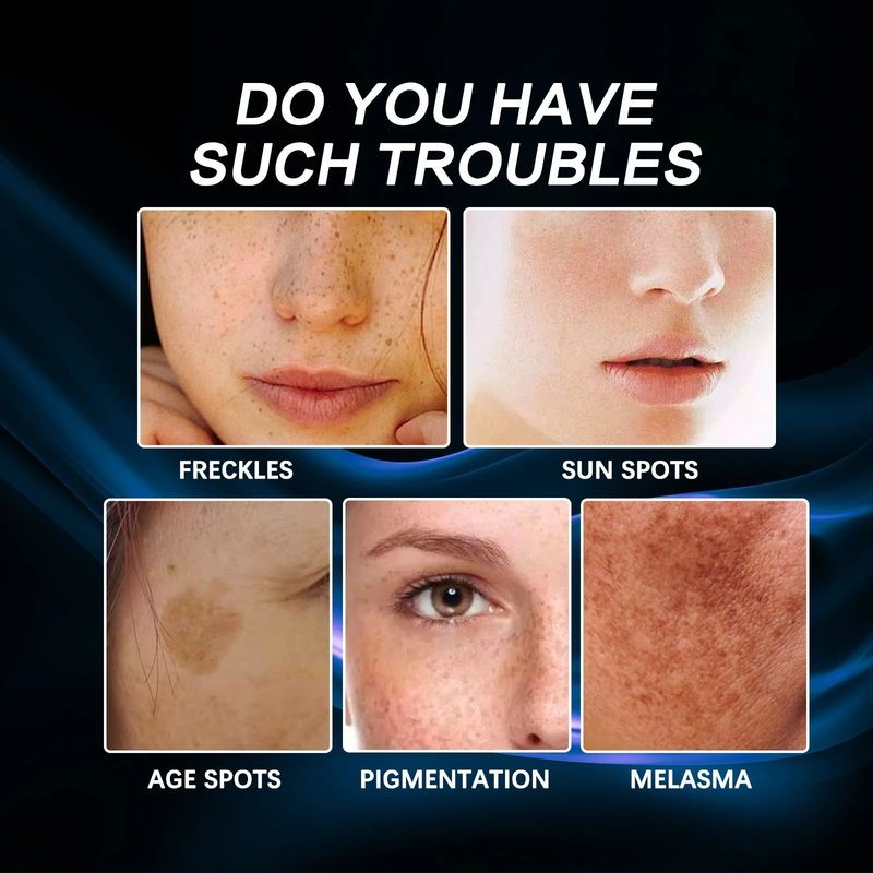 Vitamin C Whitening and Anti-Freckle Cream