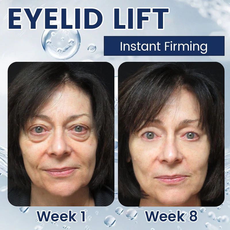 Eye Bag Removal Cream- 💖Buy 1 Get 1 Free (2 PCS)💖