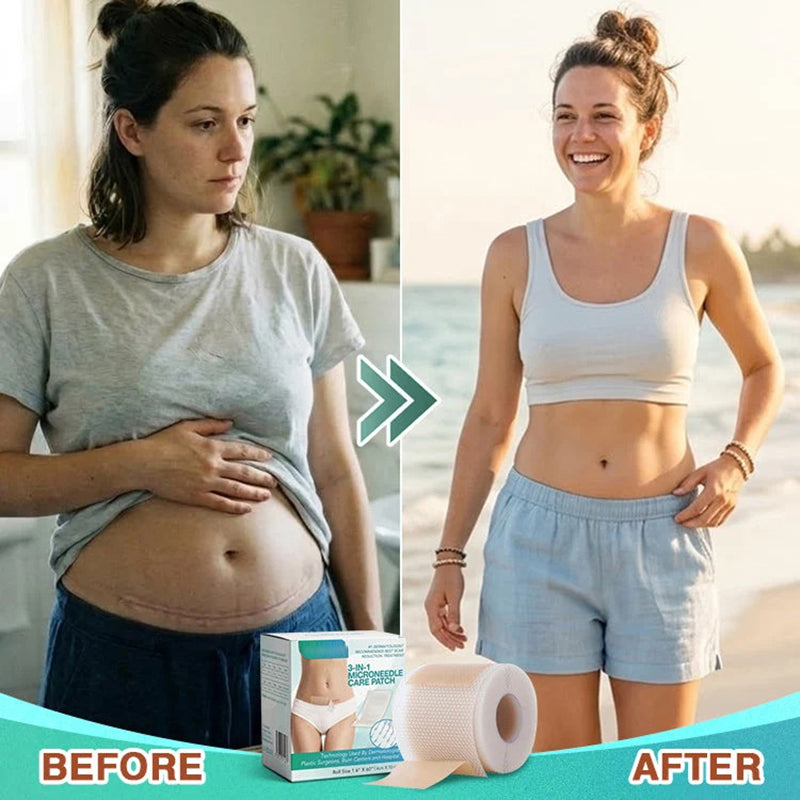 3-in-1 Scar-Fading Skincare Patch