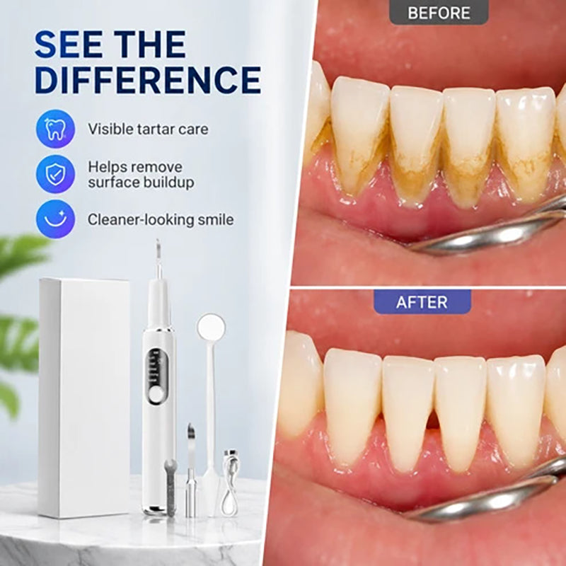 Electric Dental Scaler