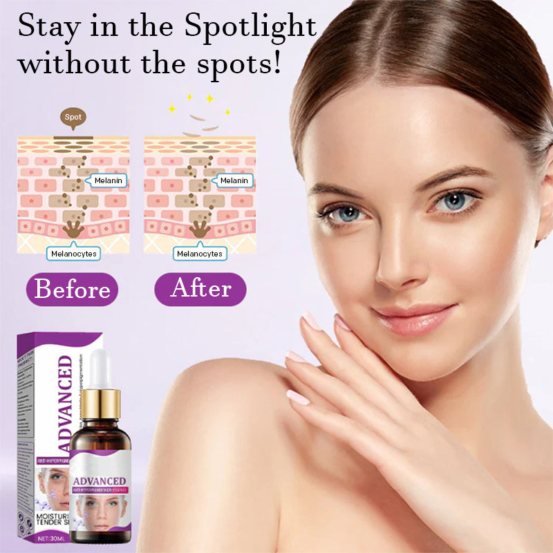 Advanced Anti-Pigmentation Serum