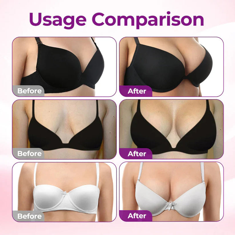 Targeted Breast-Enhancing Microneedle Patch