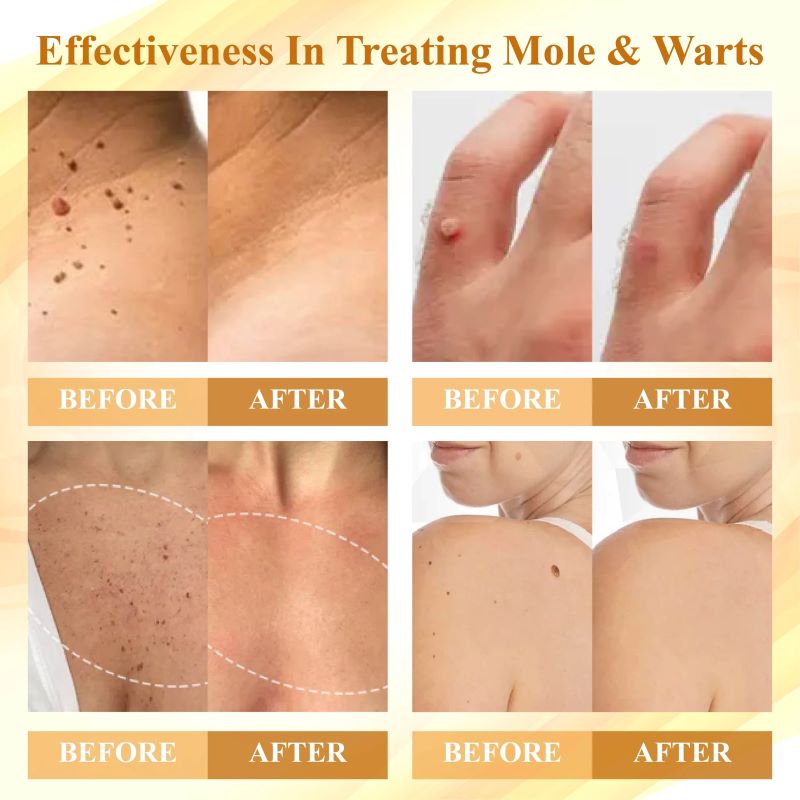 Condense Mellifera Venom Skin Repairing cream