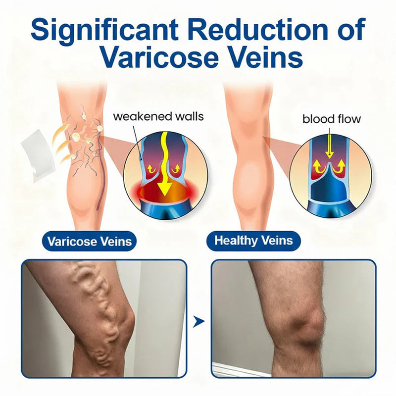 VeinEase microneedle treatment patch