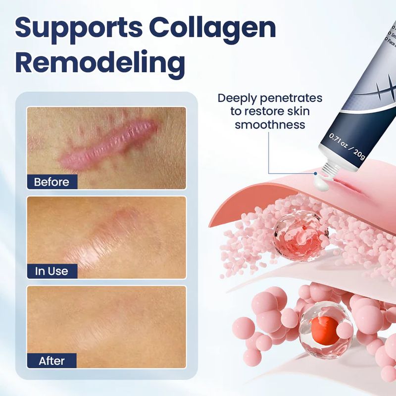 Lavender-textured scar repair gel
