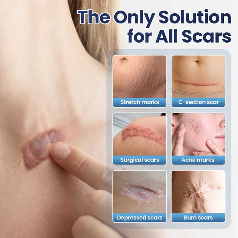 Lavender-textured scar repair gel