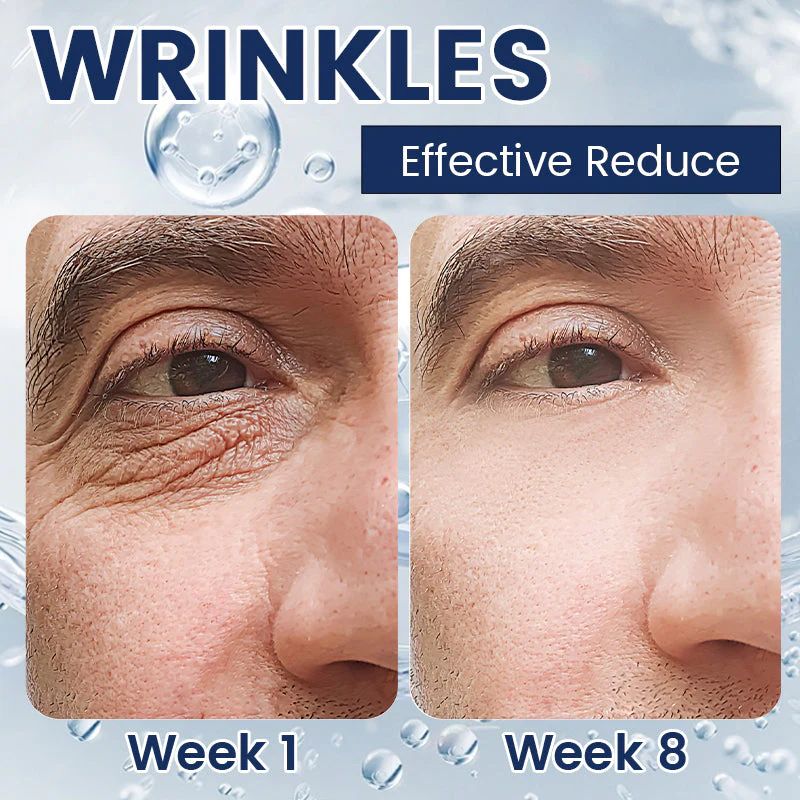 Eye Bag Removal Cream- 💖Buy 1 Get 1 Free (2 PCS)💖