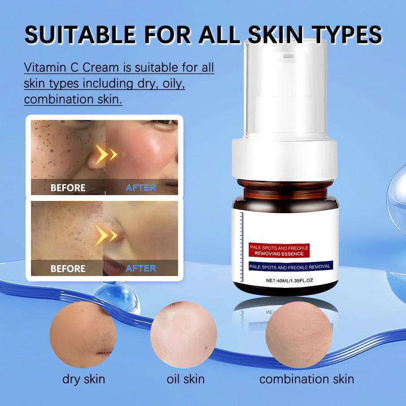 Vitamin C Whitening and Anti-Freckle Cream
