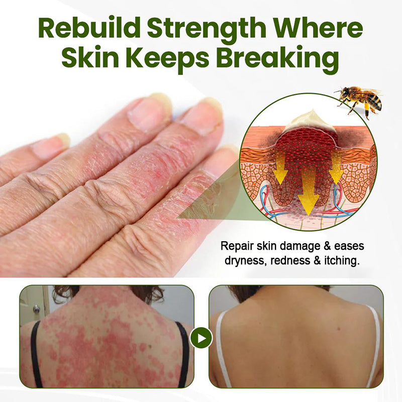 Gentle moisturizing skin care cream