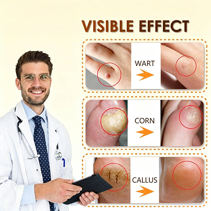 Bee Venom Corn and Callus Removal Cream