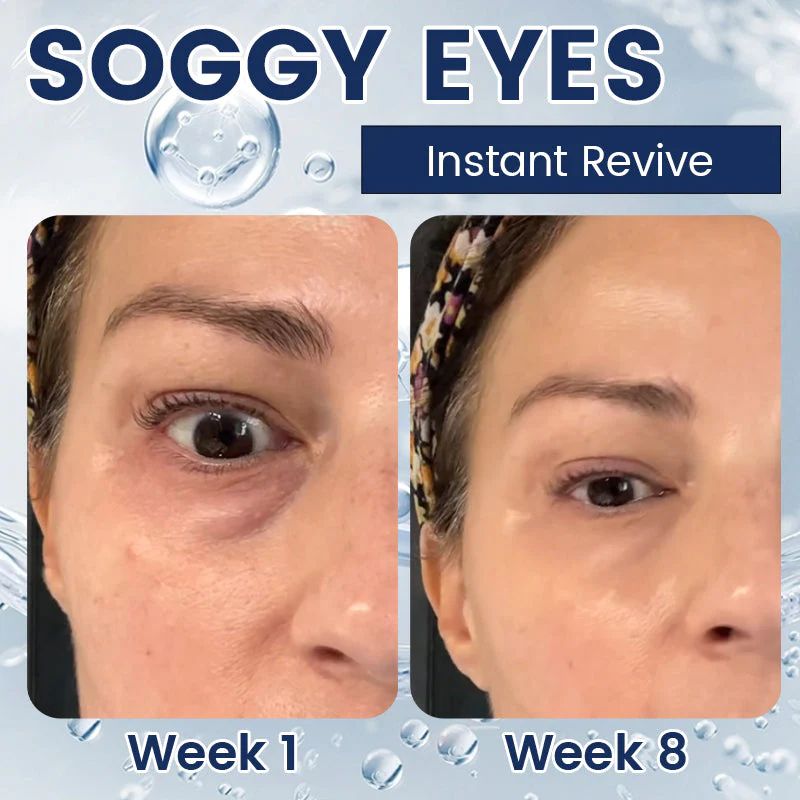 Eye Bag Removal Cream- 💖Buy 1 Get 1 Free (2 PCS)💖