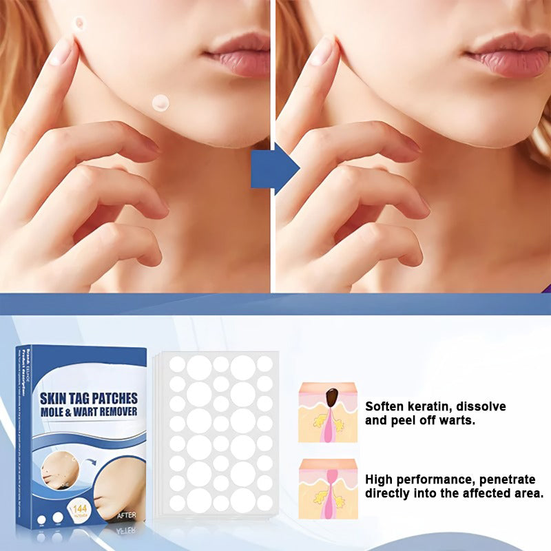 Wart and Mole Removal Patches (Buy 1 Get 1 Free)
