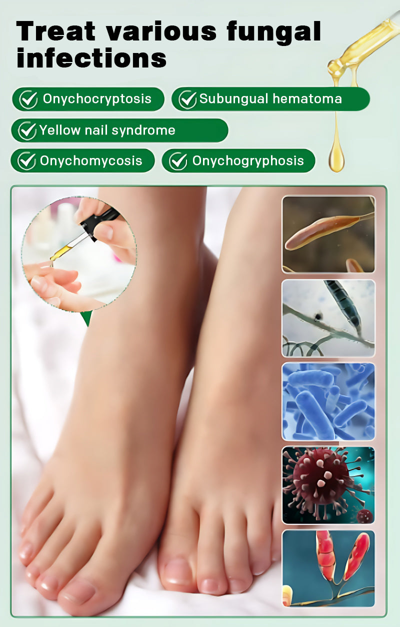 Ginger Nail Care Solution