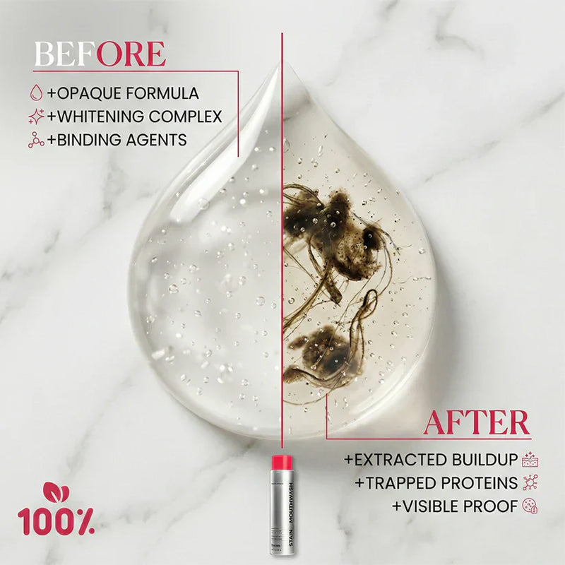Powerful stain-removing mouthwash – makes teeth whiter with every rinse