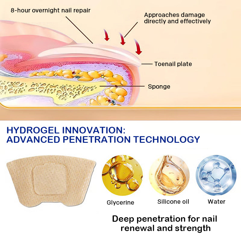 Onychomycosis stickers