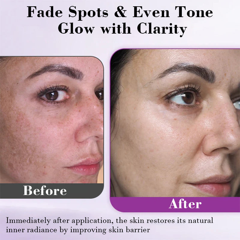 Advanced Anti-Pigmentation Serum