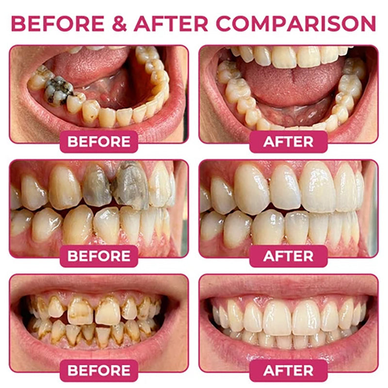 Oral Care Gel