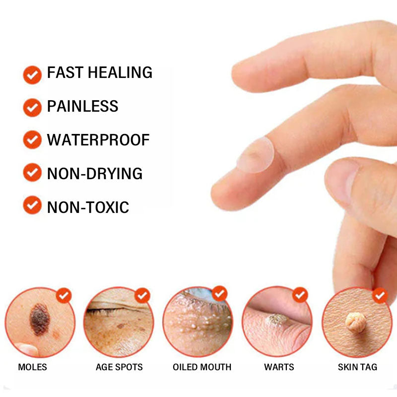 Acne and Wart Removal Microneedle Hydrocolloid Patches | - ๐Buy One Get One Free (2 Boxes)๐