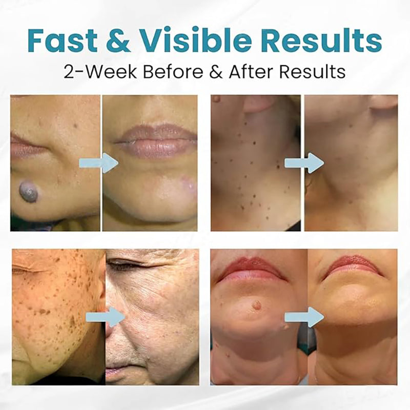 Smoothing Body Skin Care Pen