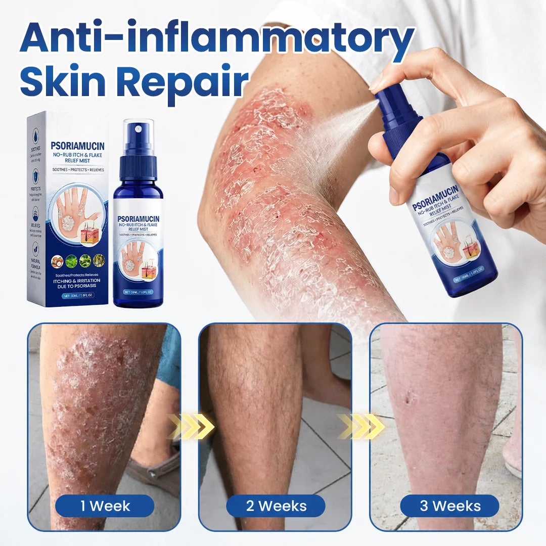 No-Rub Itch & Flake Relief Mist