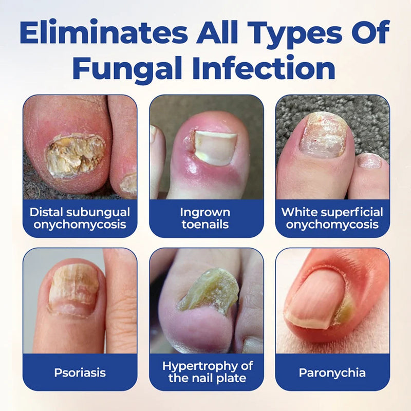 Nail care solution