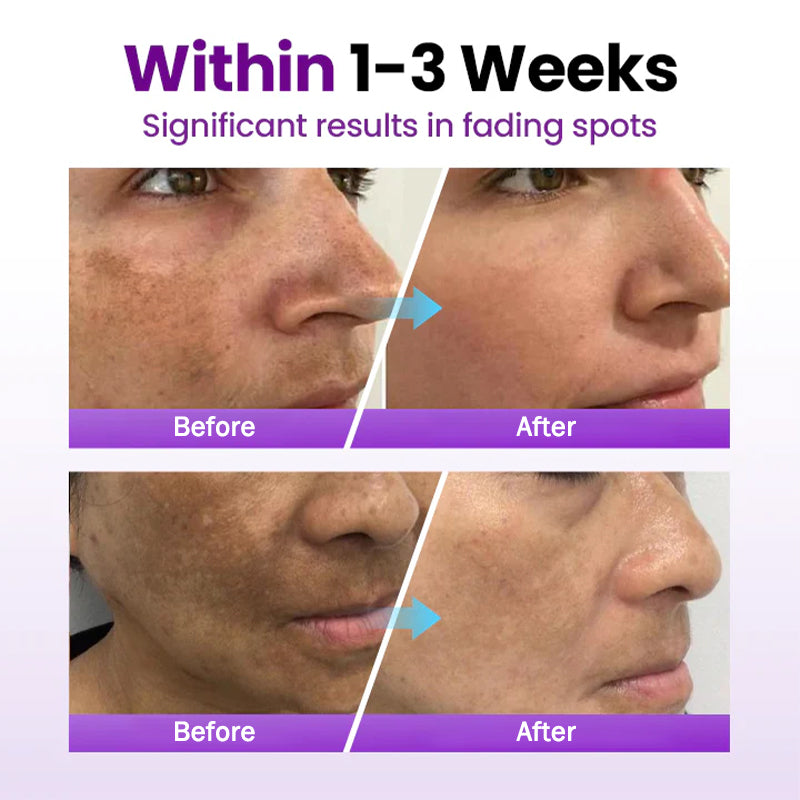 Probiotic Protective Serum