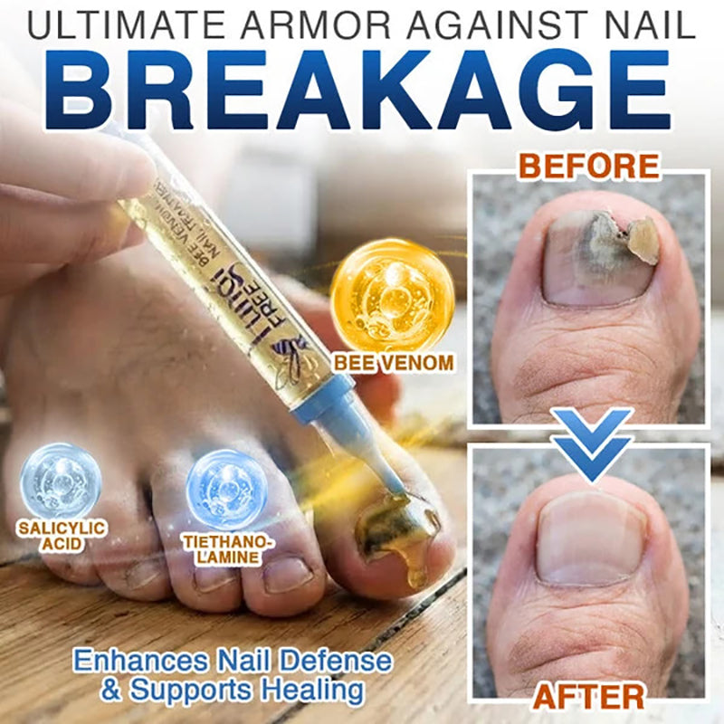 💙 Bee Venom Nail Repair Treatment Agent 🐝