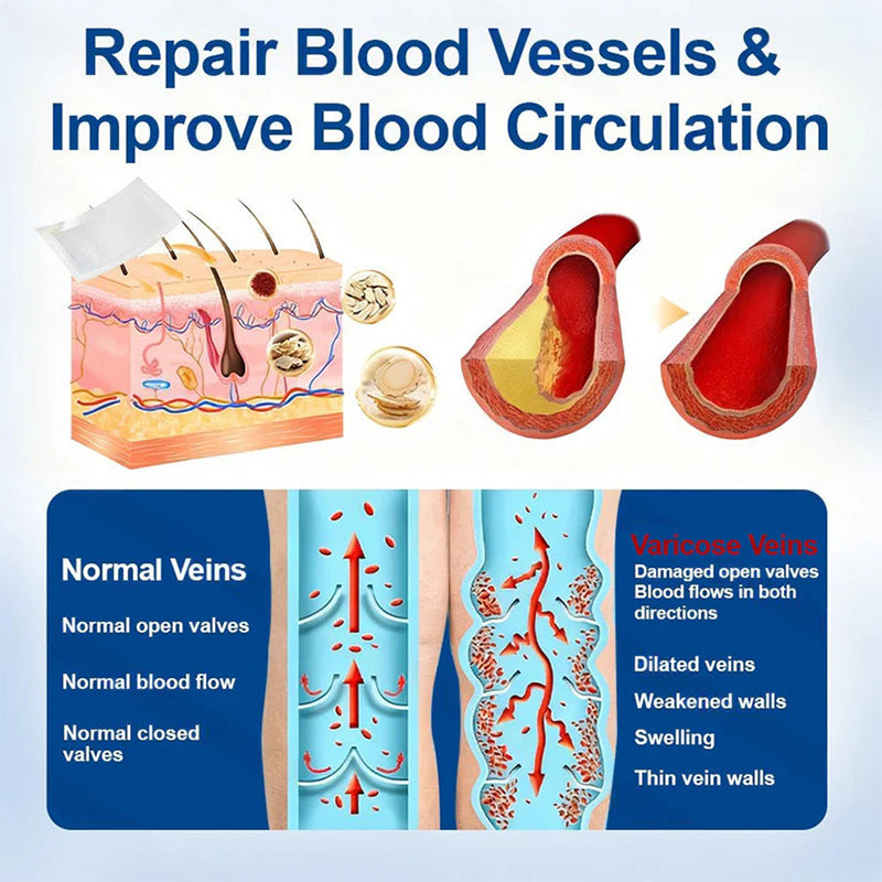 VeinEase microneedle treatment patch