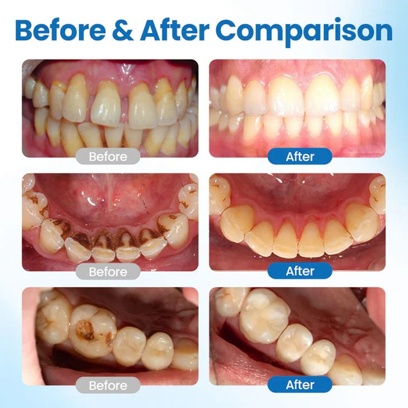 Mint-flavored dental care serum