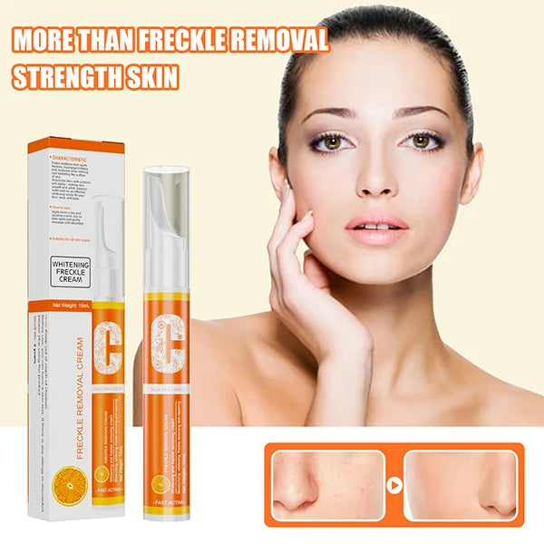 Vitamin C Freckle Dark Spot Removal Cream