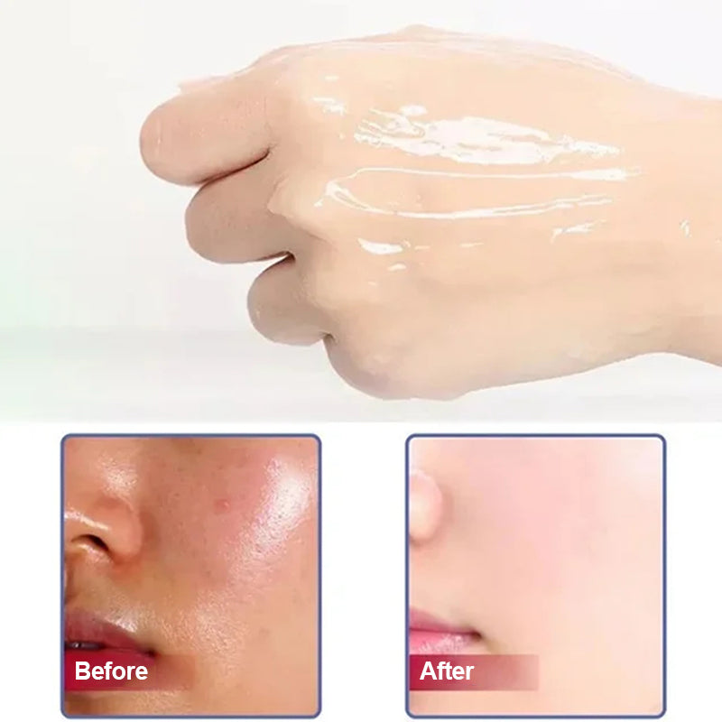 Salicylic Acid Ice Cream Mask (BUY 1 GET 1 FREE)