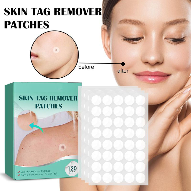 STICKERS FOR THE REMOVAL OF MOLES AND NEVI-Buy 1 Get 1 Free(2 PCS)