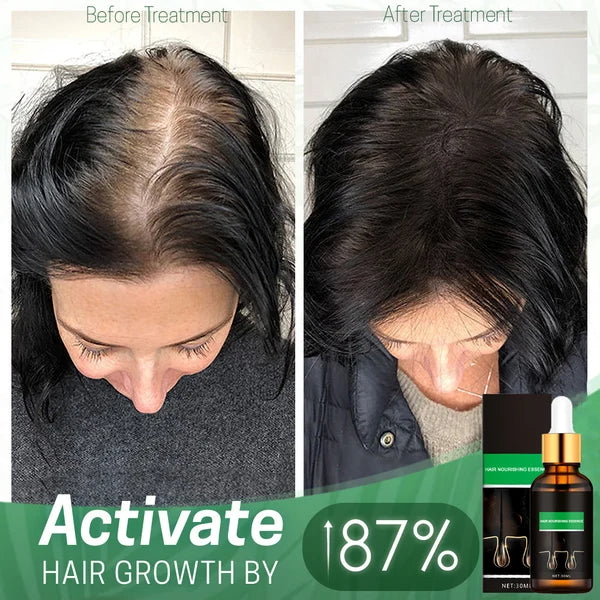 Hair Treatment & Nourishing Essence