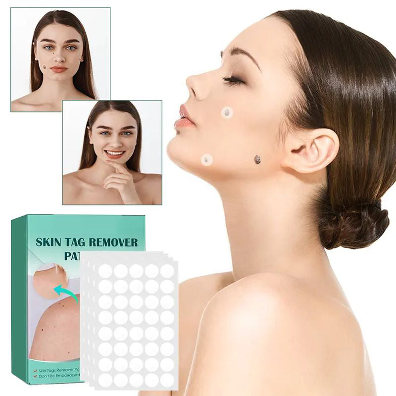STICKERS FOR THE REMOVAL OF MOLES AND NEVI-Buy 1 Get 1 Free(2 PCS)