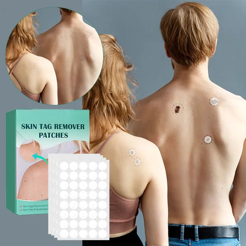 STICKERS FOR THE REMOVAL OF MOLES AND NEVI-Buy 1 Get 1 Free(2 PCS)