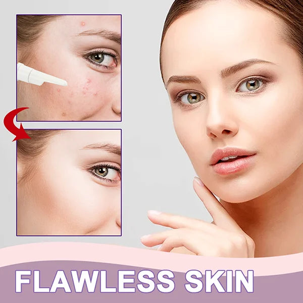 Vitamin C Freckle Dark Spot Removal Cream