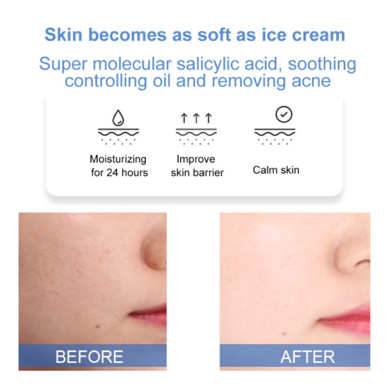 Salicylic Acid Ice Cream Mask (BUY 1 GET 1 FREE)