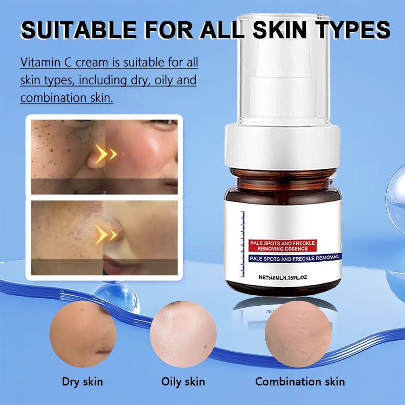 Vitamin C Freckle Whitening Cream - Buy 1 Get 1 Free (2 pcs)
