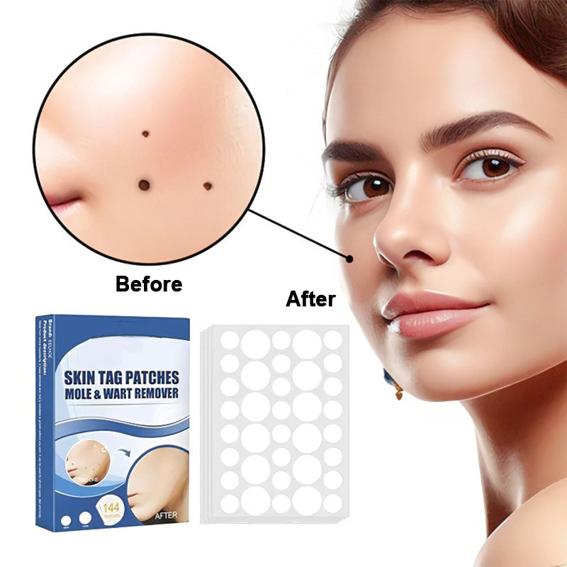Wart and Mole Removal Patches (Buy 1 Get 1 Free)