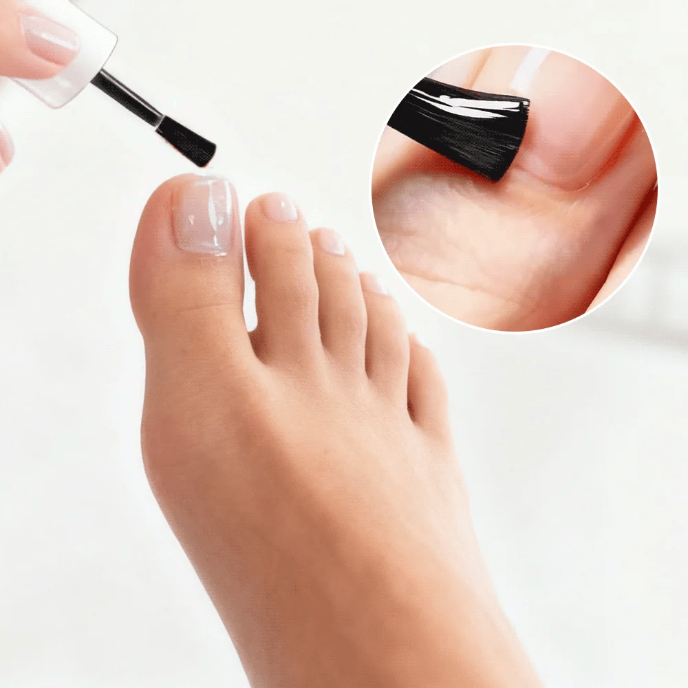 Antifungal Nail Solution