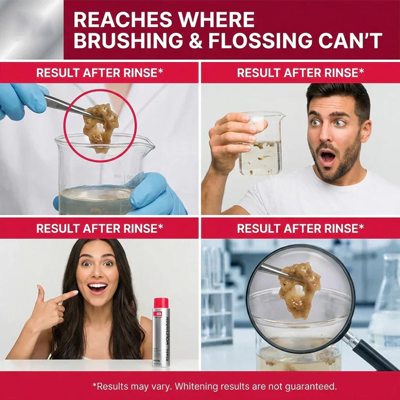 Powerful stain-removing mouthwash – makes teeth whiter with every rinse