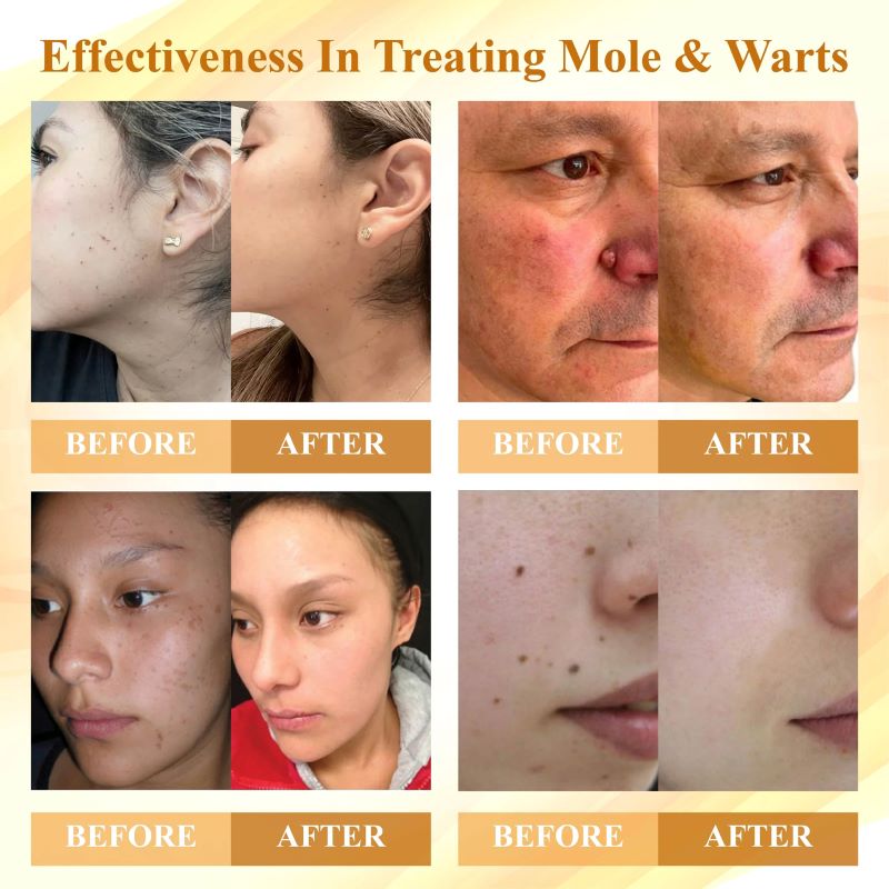 Condense Mellifera Venom Skin Repairing cream