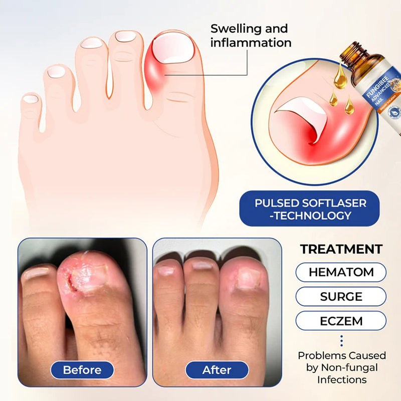 Nail care solution
